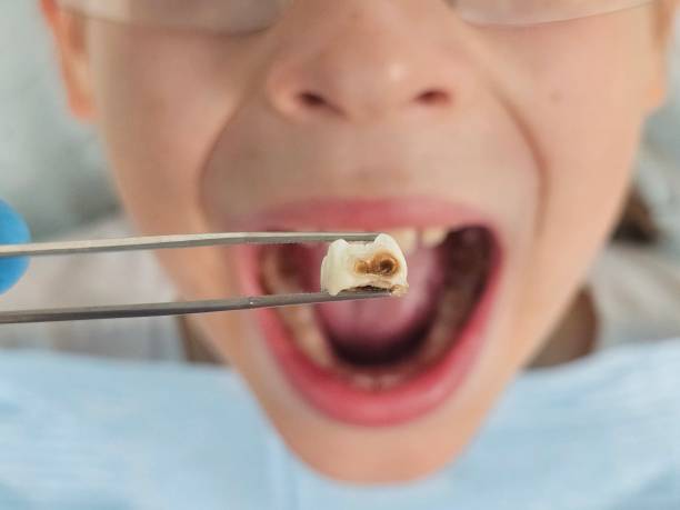 Best Teeth Whitening  in Dublin, GA